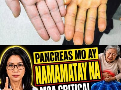 Nakamamatay Na Lihim Sa Loob Ng Tiyan: 8 Nakagigimbal Na Senyales Ng Pancreatic Cancer Na Matagal Nang Binalewala Ng Matatanda