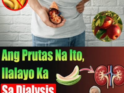 Mga Nakamamatay Na Sikreto Sa Loob Ng Bahay: 3 Uri Ng Prutas Na Tahimik Na Nagliligtas Sa Mga Bato Mula Sa Panghabambuhay Na Dialysis
