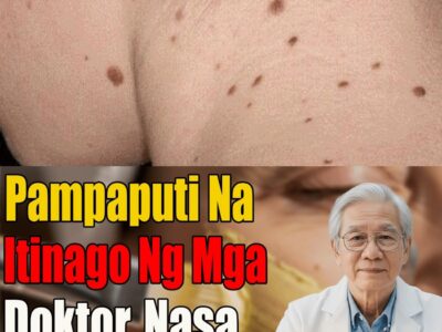 Nabunyag Ang Sikreto Ng Dermatologist: Simpleng Recipe Sa Kusina Para Mabilis Na Matanggal Ang Mga Dark Spots At Blemishes