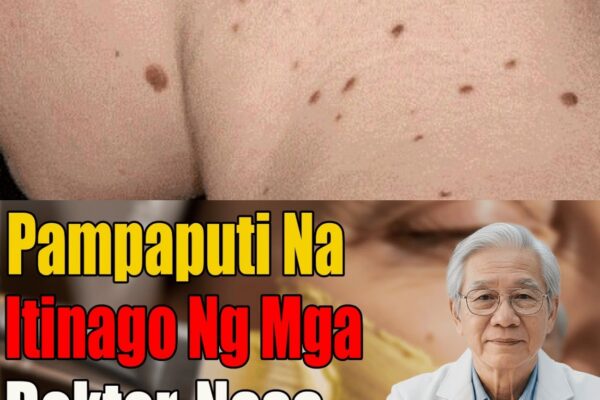 Nabunyag Ang Sikreto Ng Dermatologist: Simpleng Recipe Sa Kusina Para Mabilis Na Matanggal Ang Mga Dark Spots At Blemishes