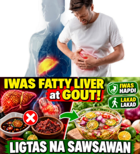 Ang paboritong sarsa ni Masa, isang TAHIMIK NA LASON na unti-unting sumisira sa kanyang atay at bato!